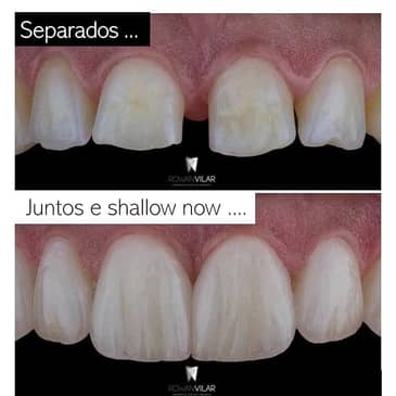 Slider image (3) Dr. Rowan Vilar - Best Dentist in Rio de Janeiro